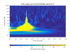 943424949.906_V1:Bs_Ampli_out_1.00