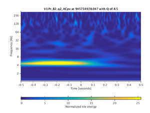 945734978.047_V1:Pr_B2_q2_ACpv_1.00