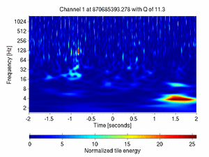 870685393.27807617_V1:Bs_IMC_DR_DC_4.00