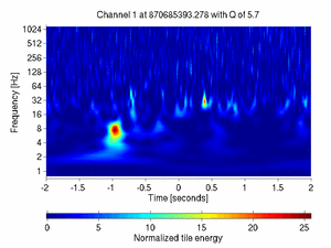 870685393.27807617_V1:Ca_BS_RM_CoilDR_4.00