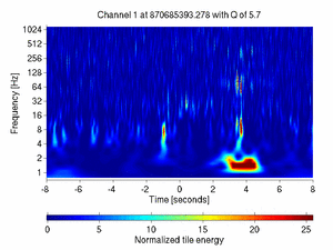 870685393.27807617_V1:Ca_BS_RM_CoilUL_16.00