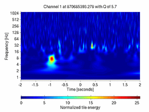 870685393.27807617_V1:Ca_BS_RM_CoilUL_4.00