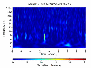870685393.27807617_V1:Ca_BS_RM_CoilUR_16.00