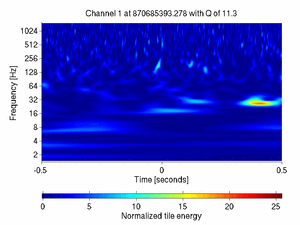 870685393.27807617_V1:Ca_PR_RM_CoilD_1.00